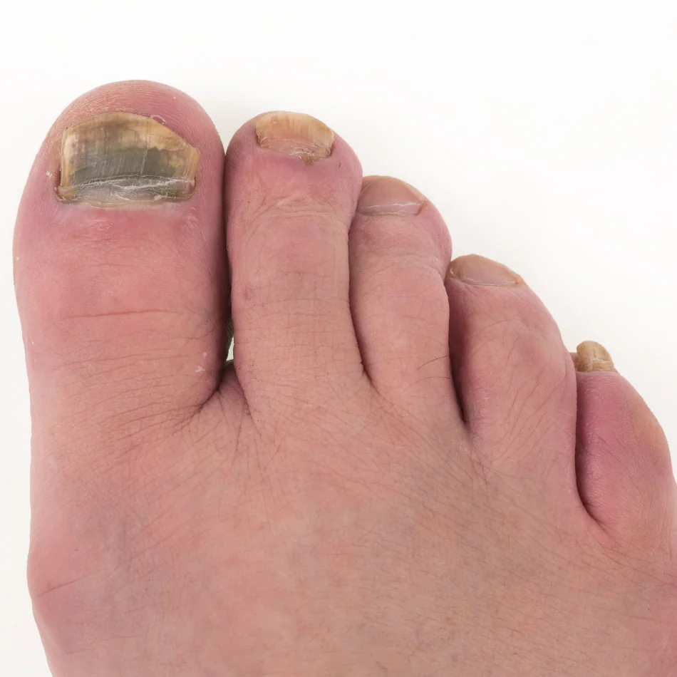 indice de dermatologia