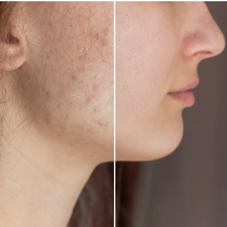 indice de dermatologia