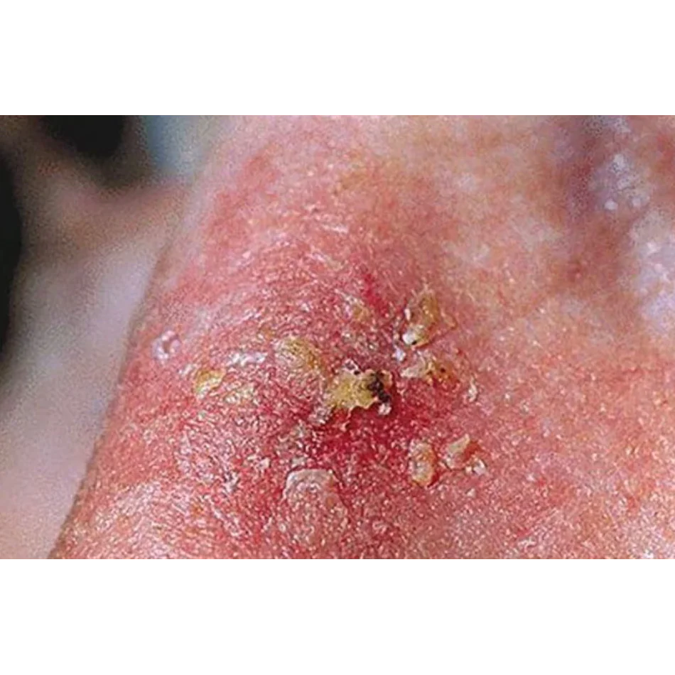 indice de dermatologia