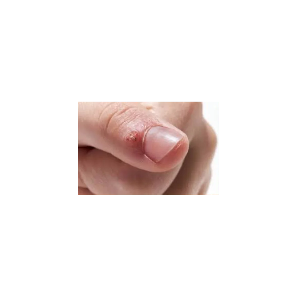 indice de dermatologia