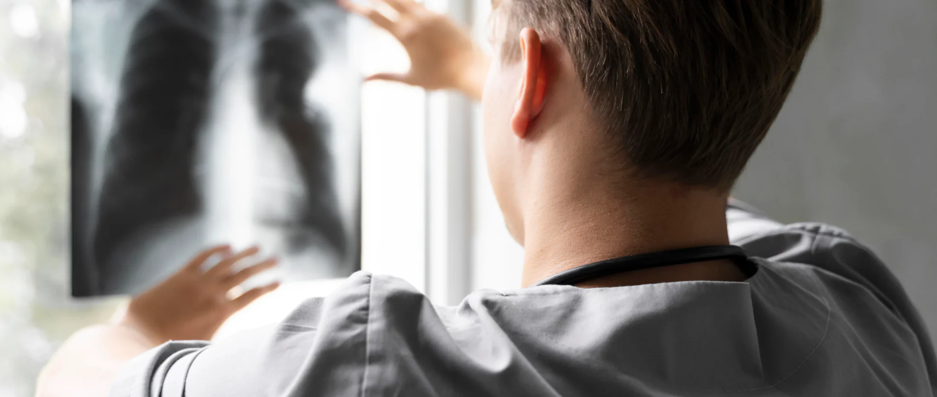 Urticaria Crónica