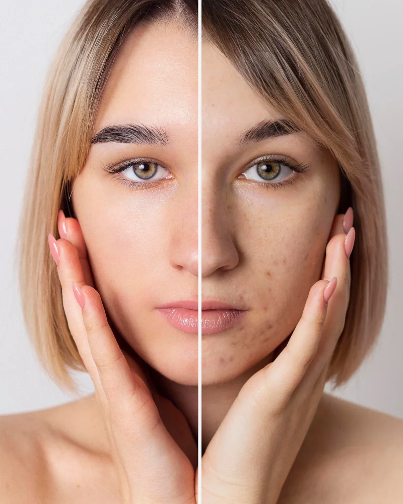 Imagen de mujer antes y despues